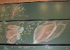 Myologie du Membre Supérieur - DSCN7664.jpg (442 ko)