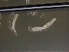 Myologie du Membre Supérieur - DSCN7691.jpg (418 ko)