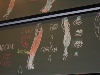 Myologie du Membre Supérieur - DSCN7692.jpg (432 ko)