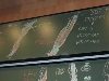 Myologie du Membre Supérieur - DSCN7694.jpg (440 ko)