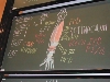 Myologie du Membre Supérieur - DSCN7695.jpg (441 ko)