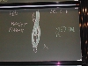 Myologie du Membre Supérieur - DSCN7715.jpg (420 ko)
