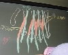 Myologie du Membre Supérieur - DSCN7720.jpg (377 ko)